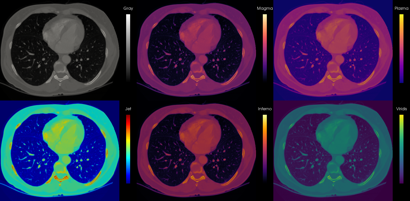 Better than the rainbow: The Matplotlib alternative colormaps | medvis.org